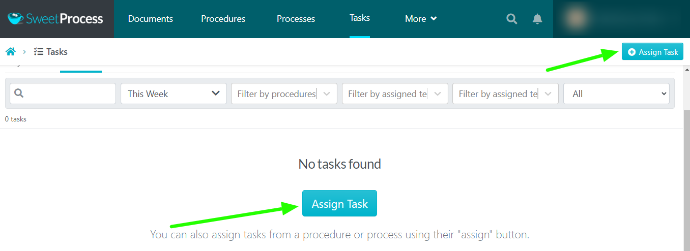 new page where you can assign and track the progress of tasks.