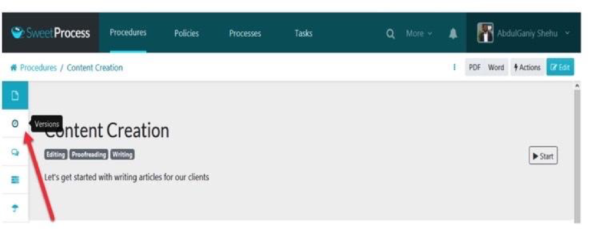 Once the procedure page loads, click on the icon indicated 